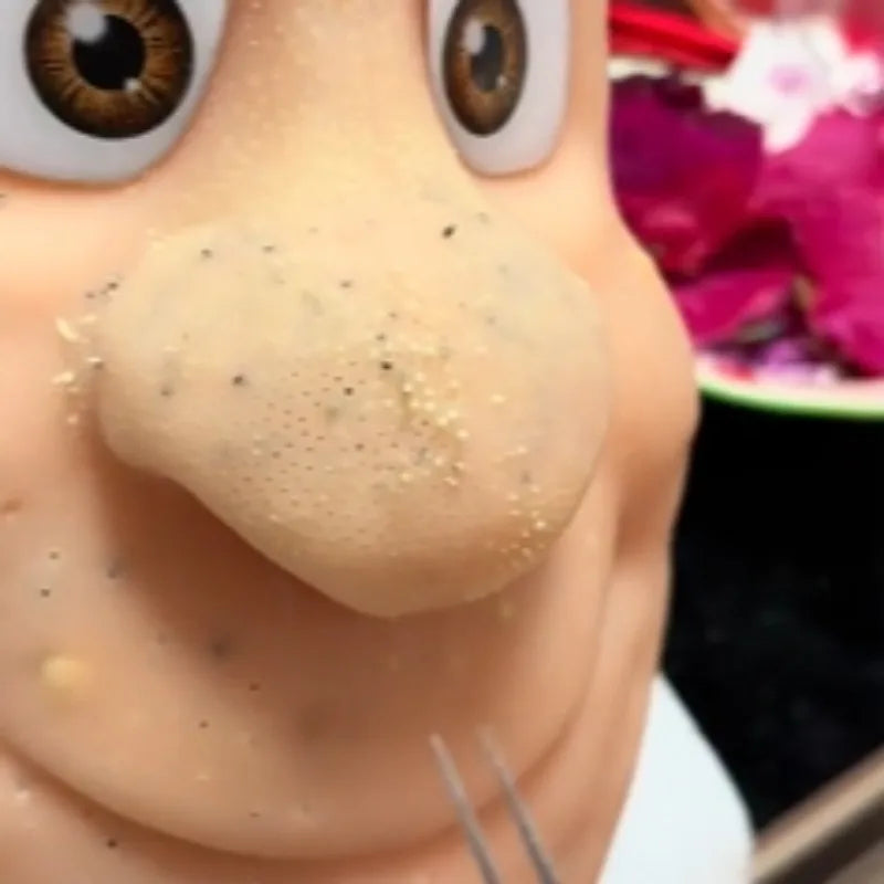 PopZen™ Squeeze Acne Toy — The Most Satisfying Stress-Relief Experience Ever!