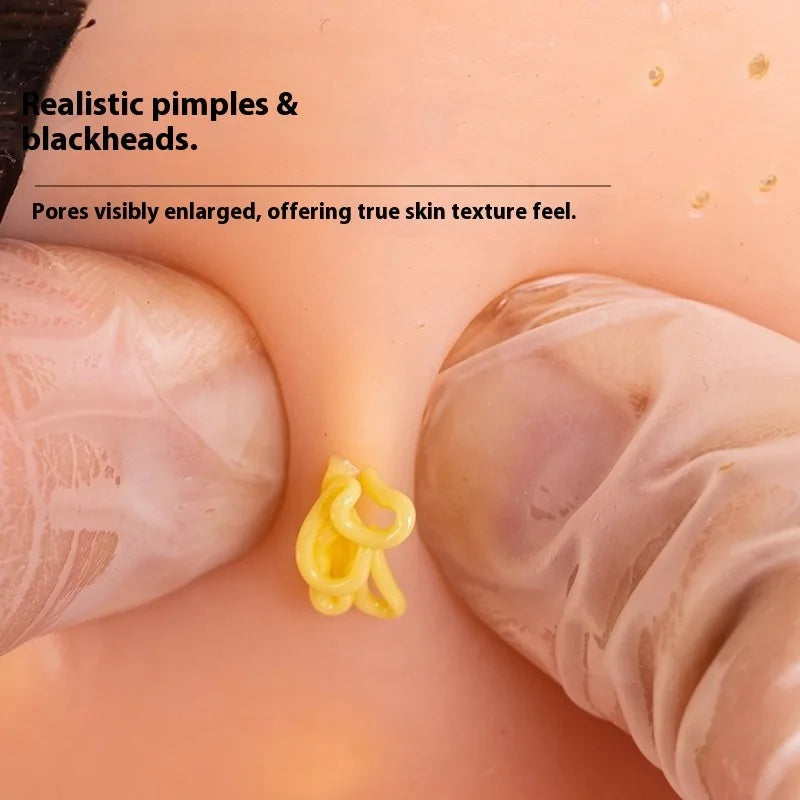 PopZen™ Squeeze Acne Toy — The Most Satisfying Stress-Relief Experience Ever!